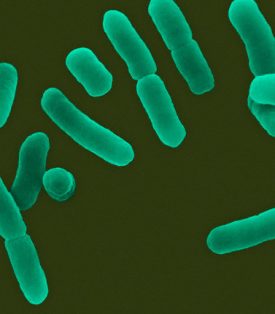 Lactobacillus Bacteria are gram-positive, non-spore forming, anaerobic or microaerophilic rods that occur singly or in pairs. They are part of the human microbiota and are important in commercial lactic acid production for food products. SEM X2925 --- Image by © Dr. Dennis Kunkel/Visuals Unlimited/Corbis